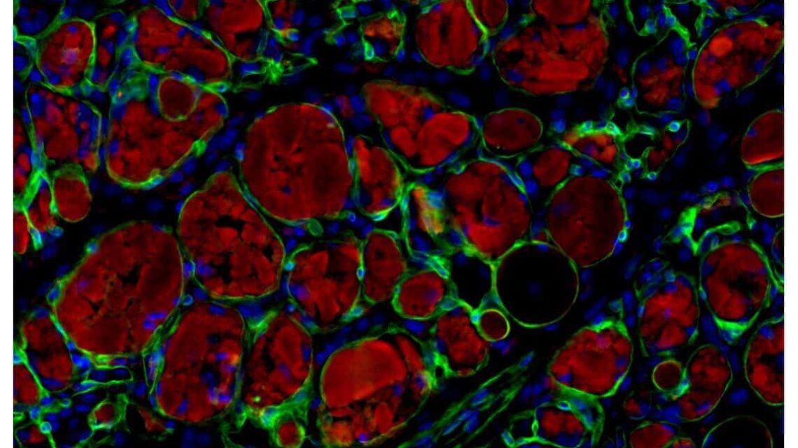 El cóctel químico crea nuevas vías para las terapias con células madre musculares