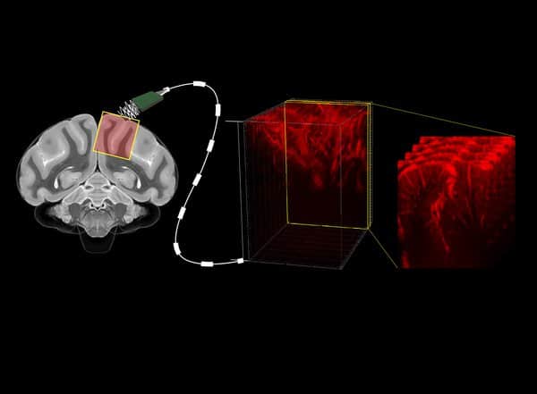 Leer la mente con ultrasonido: una técnica menos invasiva para decodificar las intenciones del cerebro