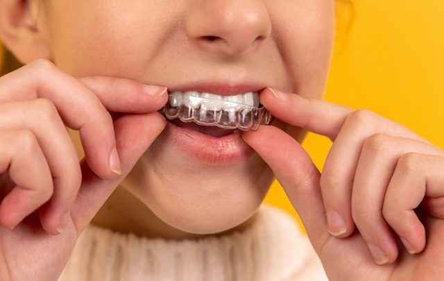 Las ventajas para la salud de los dientes alineados
