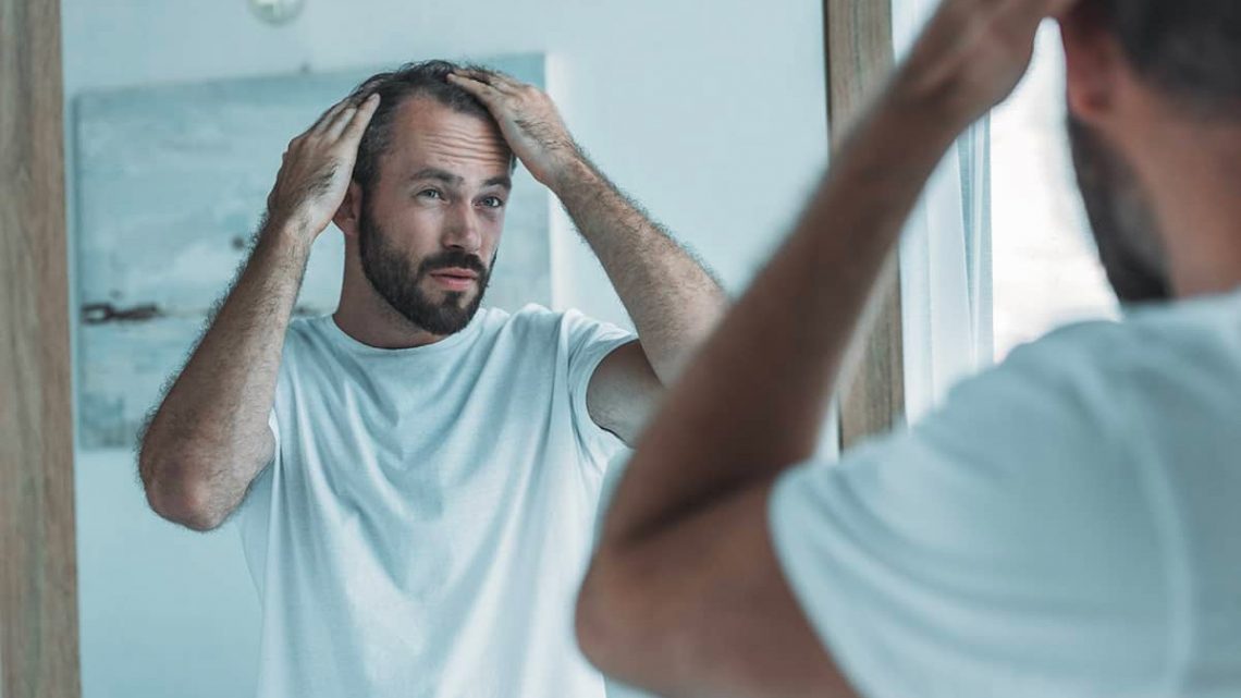 Las 5 razones principales por las que podría arrepentirse de un trasplante de cabello