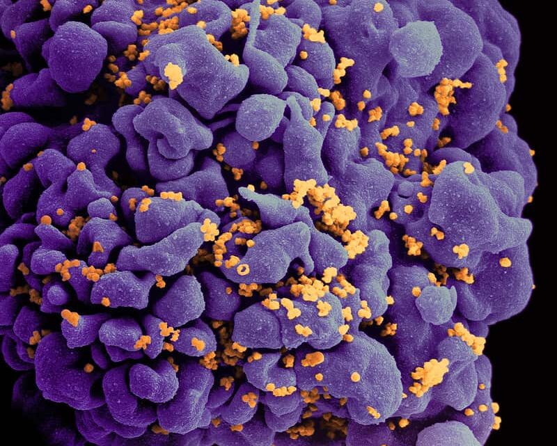 Investigadores de los NIH identifican cómo dos personas detectaron el VIH después de suspender el tratamiento