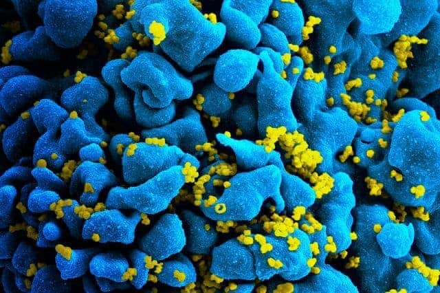Los científicos identifican al segundo paciente con VIH cuyo cuerpo parece haberse deshecho del virus