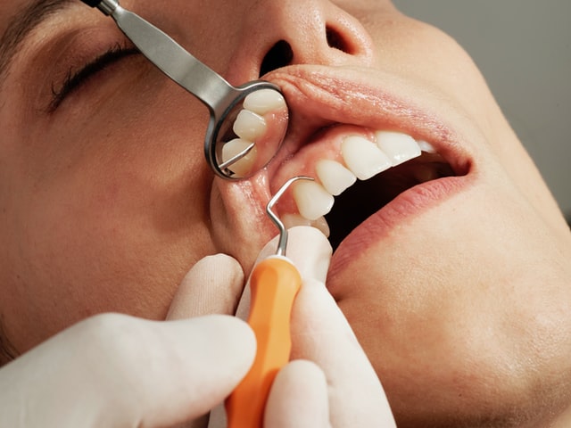 Cómo prepararse para un procedimiento dental