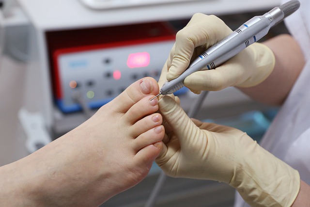 Cómo encontrar servicios de prevención y cuidado del pie diabético en Torrance CA