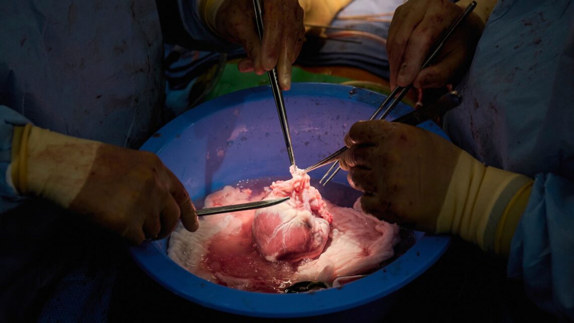 Los trasplantes de órganos porcinos se acercan un poco más con las pruebas en los muertos